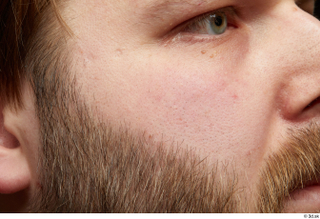 HD Face Skin Robert Watson cheek face nose skin pores…